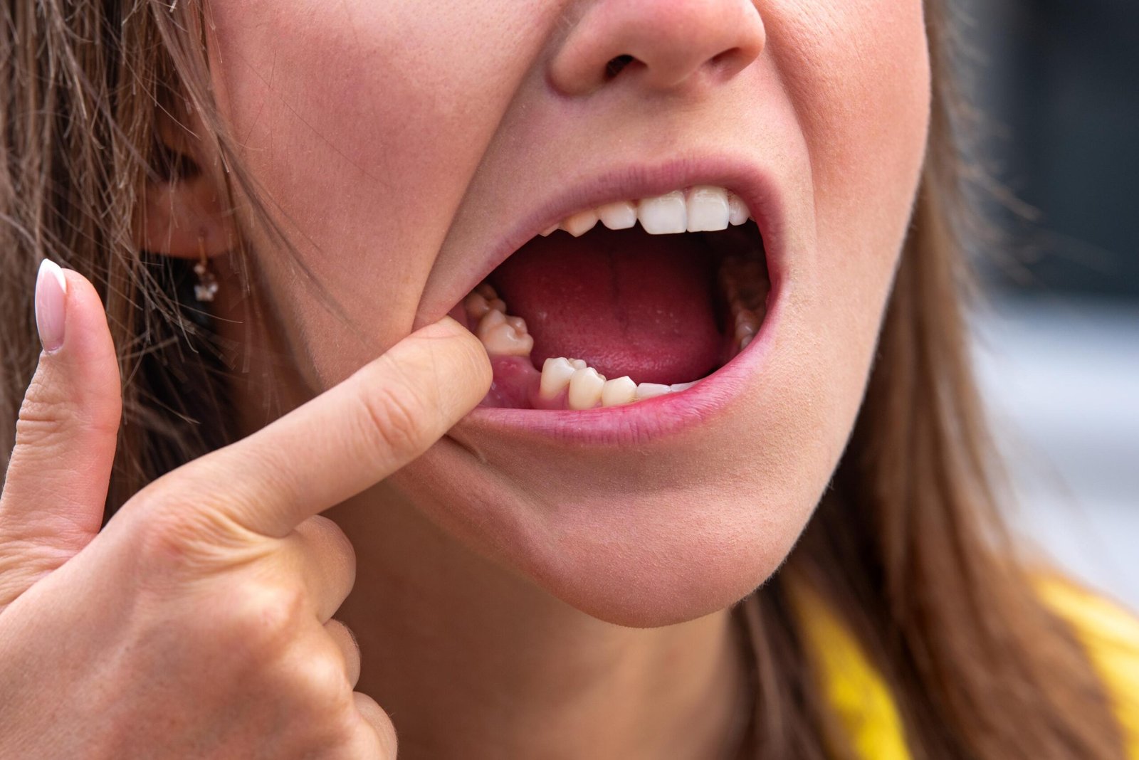 The Importance of Regular Dental Check-Ups